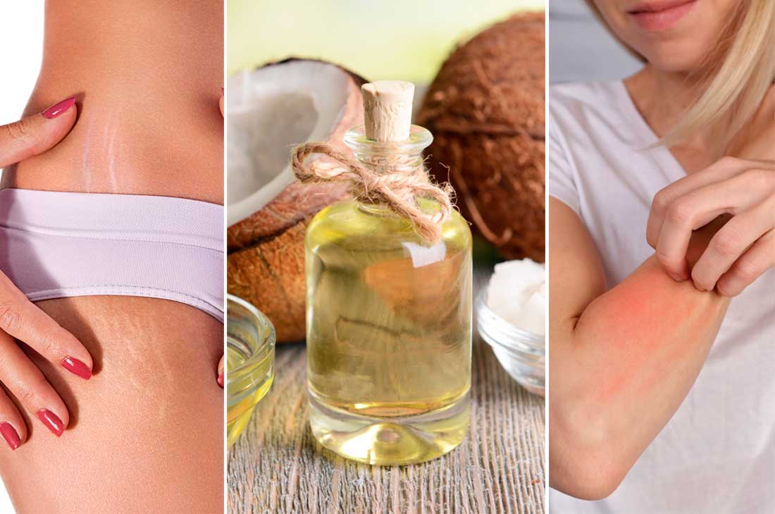 Usos alternativos del aceite de coco. Conoce algunos beneficios que el aceite de coco le brinda a tu cuerpo, piel y cabello. ¡Checa aquí y úsalo diario!