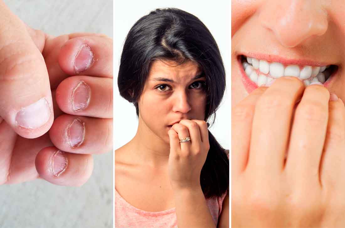 Estos trucos y remedios naturales con alimentos te ayudarán a dejar de comerte las uñas y a mejorar la apariencia de tus manos.