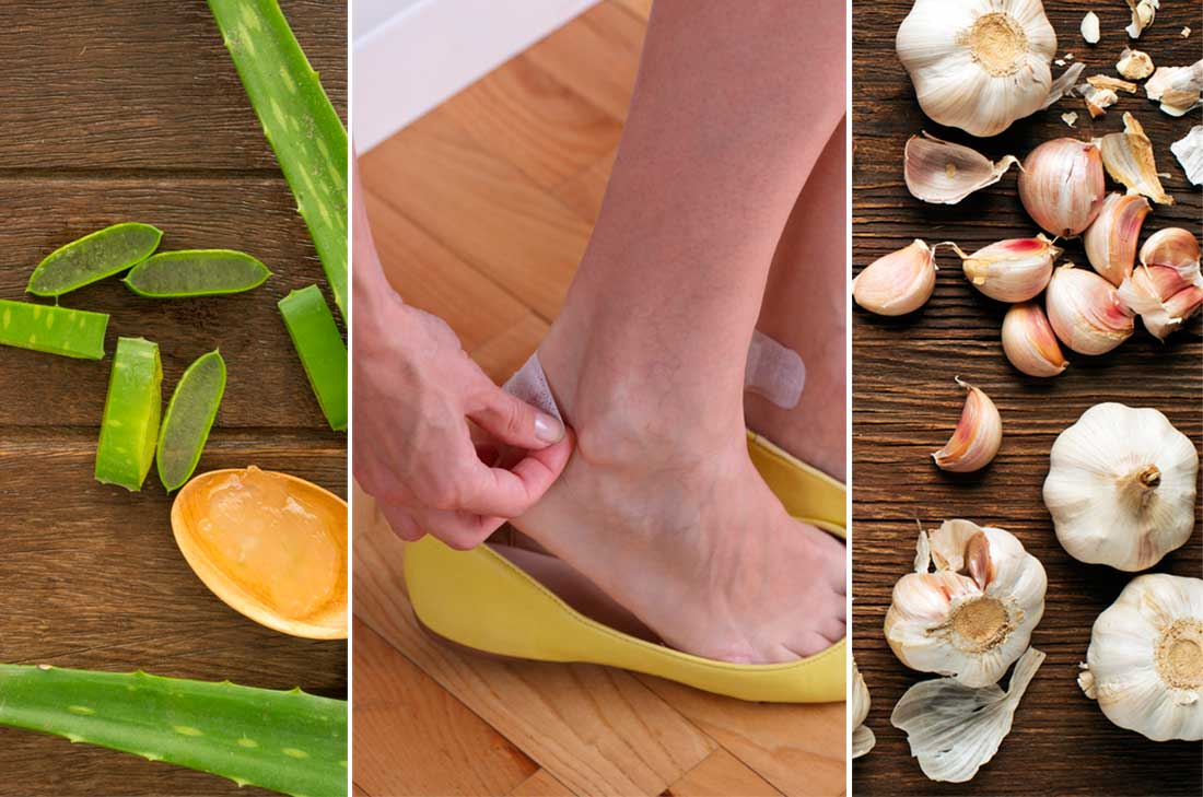 Checa estos remedios y cura las ampollas con alimentos Las ampollas y como sabes es una bolsa de piel levantada e inflamada que esta llena de líquido.