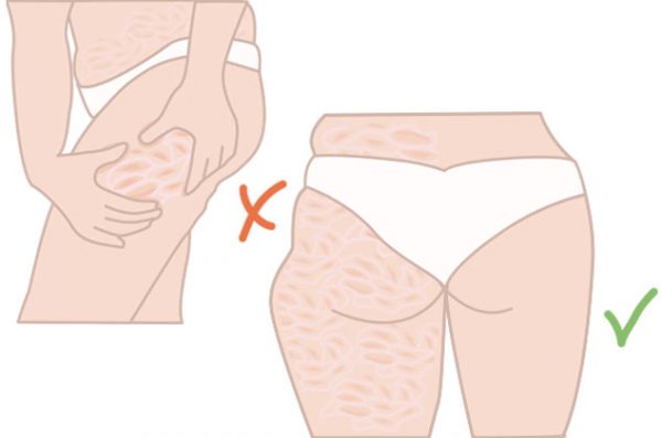 femenino Chaqueta Adivinar celulitis-piernas-piel-de-naranja-linaza | Cocina Vital