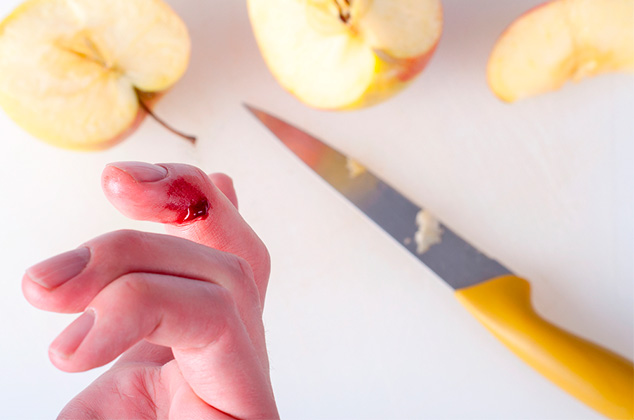 ¡Cuidado! 10 accidentes frecuentes en la cocina y cómo prevenirlos