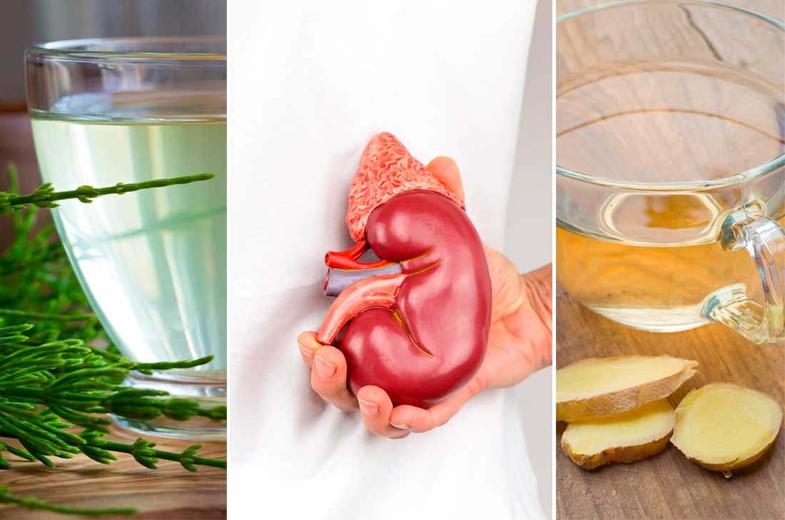 Para tratar la insuficiencia renal es necesario incluir a nuestra rutina alimentos y remedios con propiedades diuréticas. Estos son algunos.