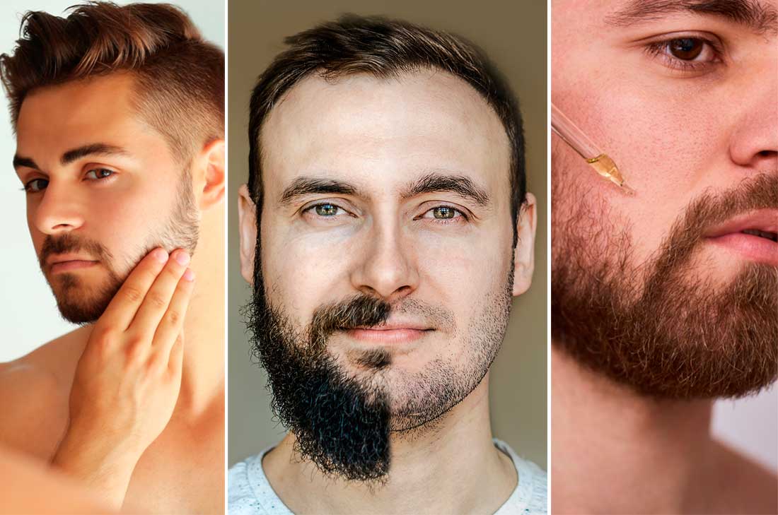 Remedios caseros para hacer crecer la barba