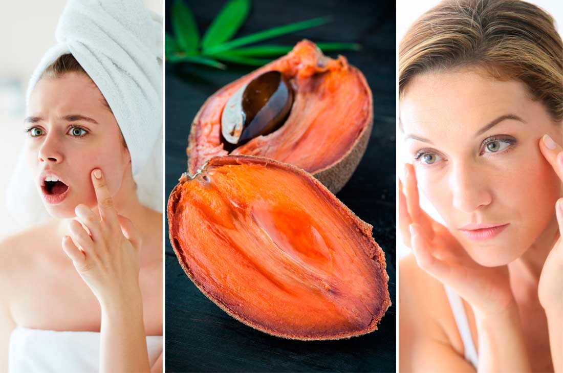 Para eliminar todas las impurezas de tu rostro, te recomendamos hacer esta mascarilla de mamey. Es muy fácil de preparar y además, muy económica.