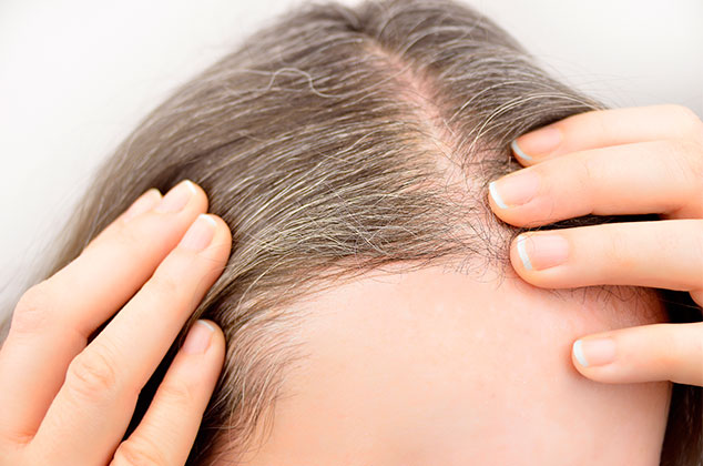 Cómo usar el bicarbonato para eliminar canas y evitar la caída del cabello