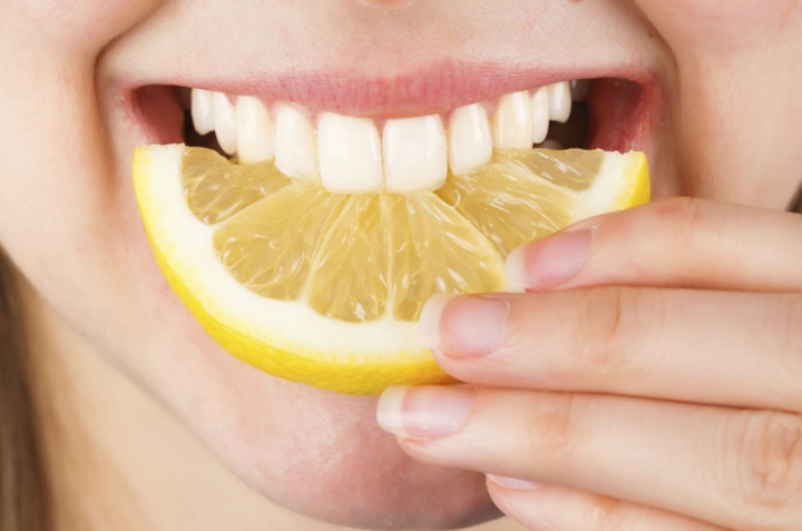como blanquear los dientes rápido