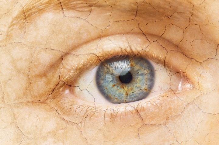 síndrosíndrome del ojo secome del ojo seco