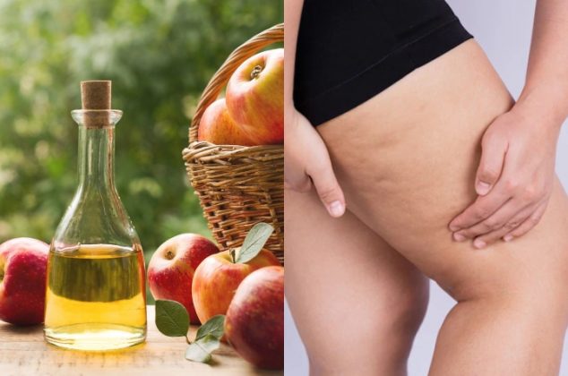 Cómo eliminar la celulitis en tus piernas con vinagre de manzana