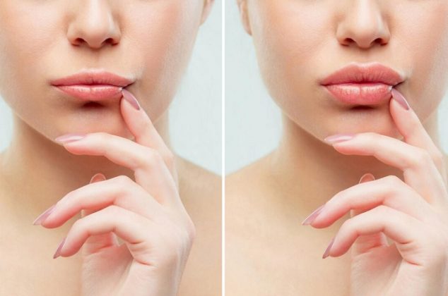 Cómo lucir unos labios gruesos y hermosos con 2 ingredientes