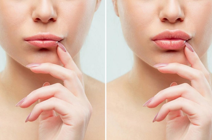 cómo lucir labios gruesos