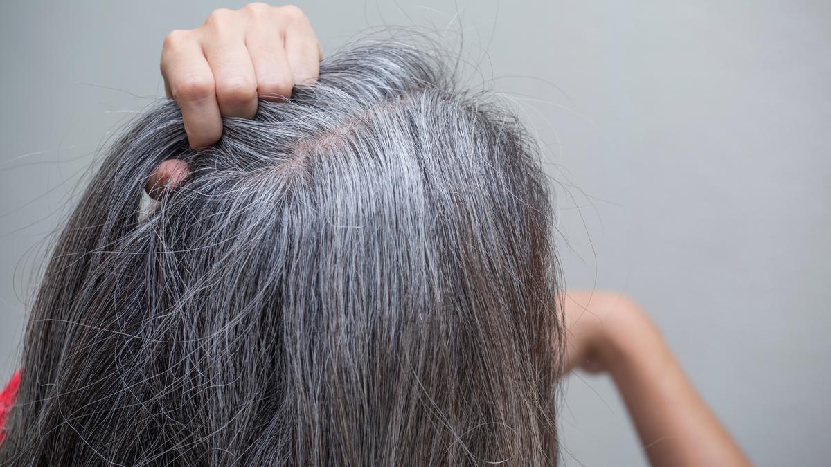 como eliminar las canas