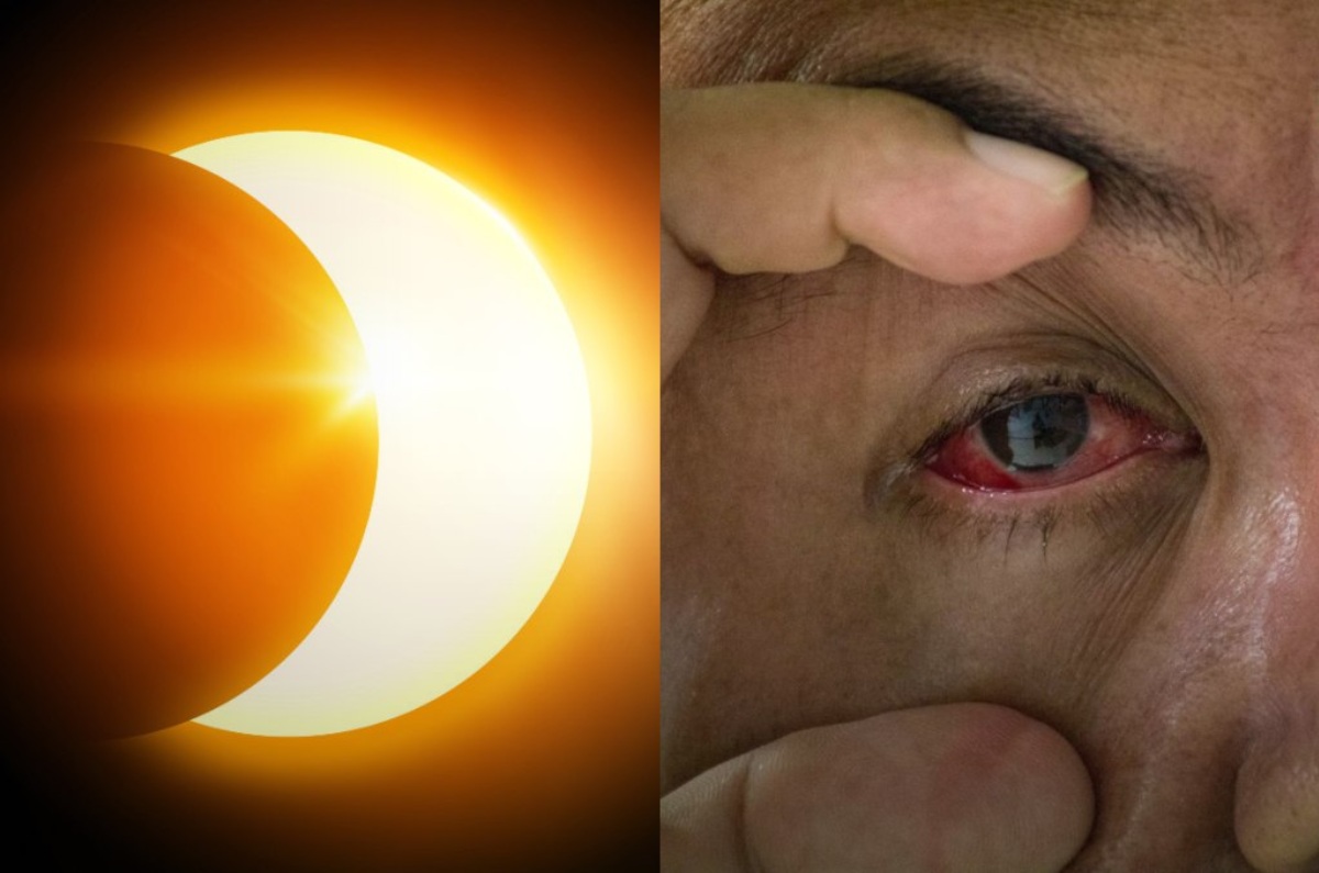 dolor de ojos después de ver el eclipse