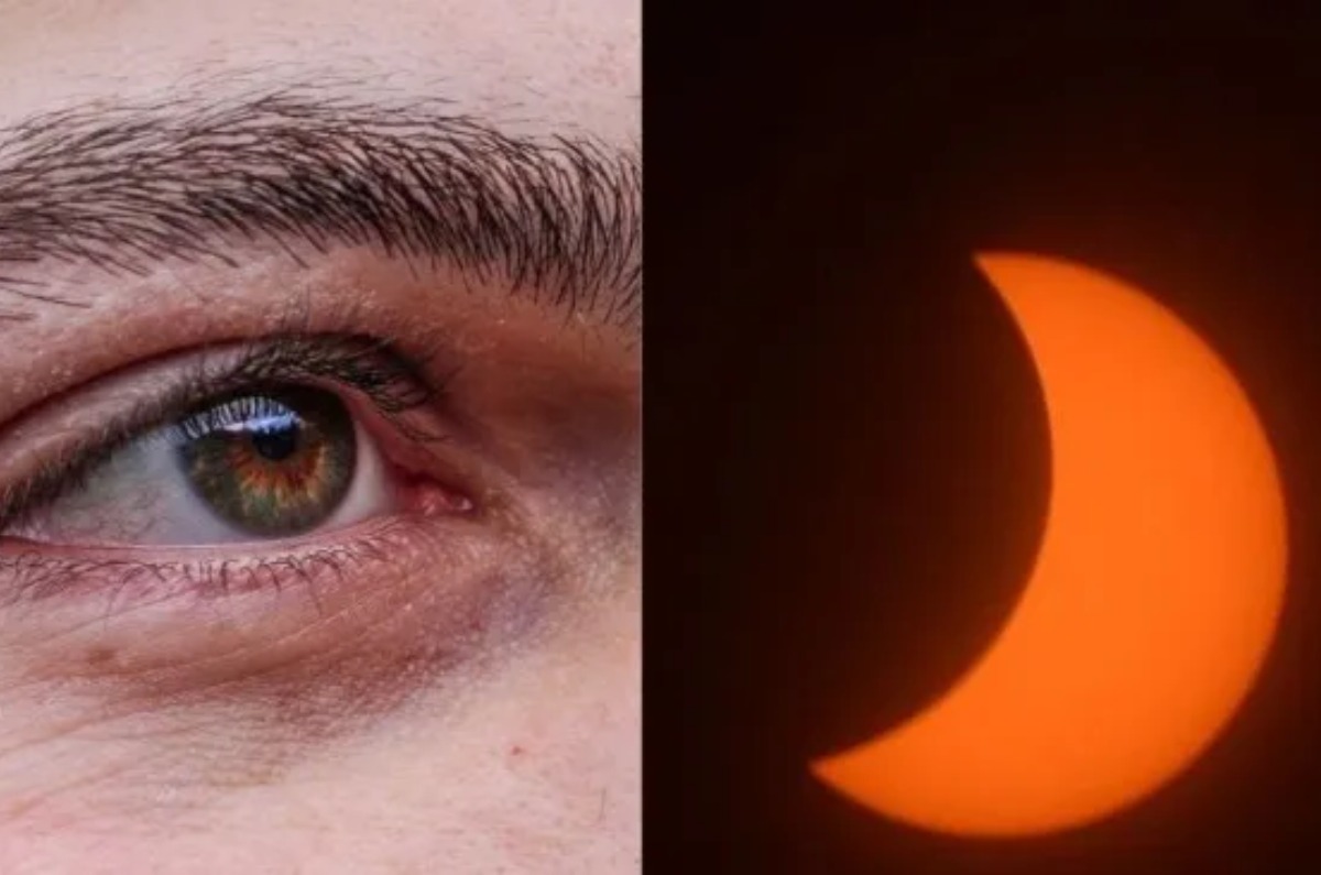 dolor de ojos después de ver el eclipse 