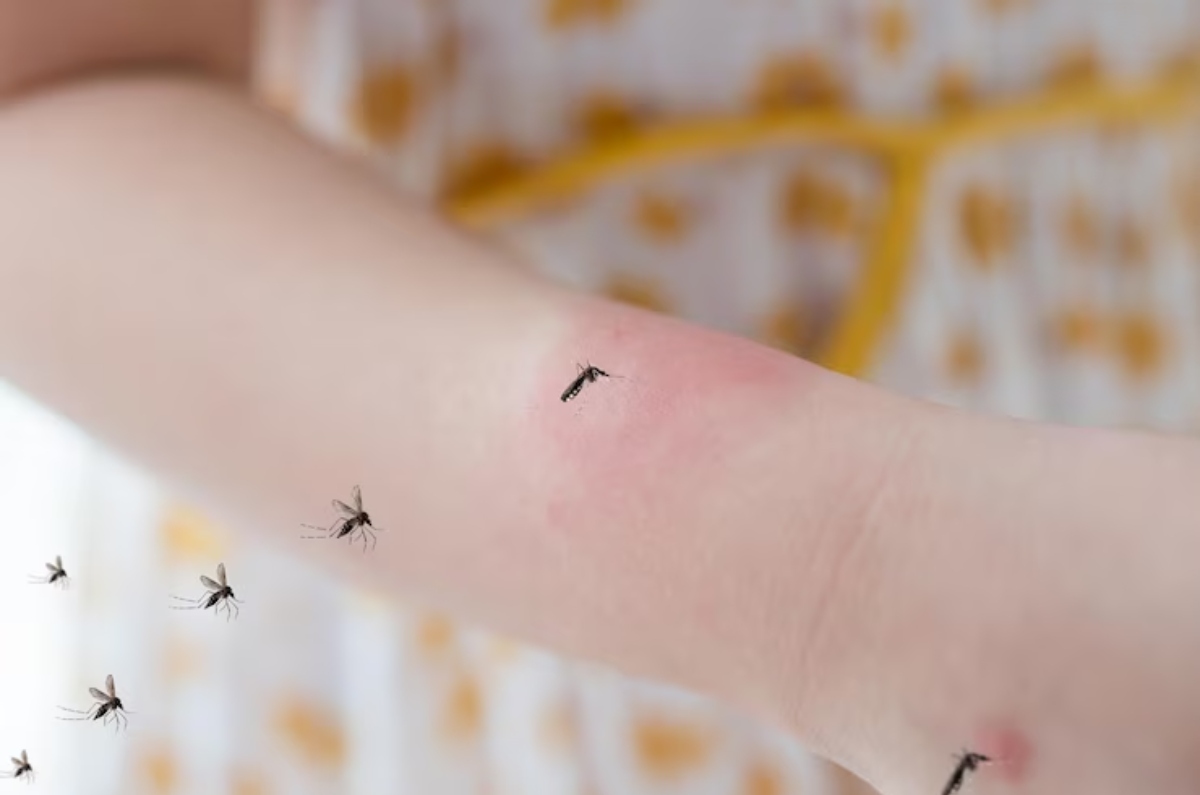 picadura de mosquito