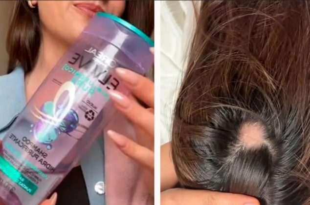 ¿Shampoo Elvive Morado provoca la caída del cabello? Esto pasa con la botella
