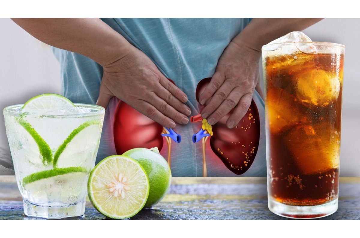 4 bebidas que podrían afectar tus riñones y es mejor evitar, según la Secretaría de Salud