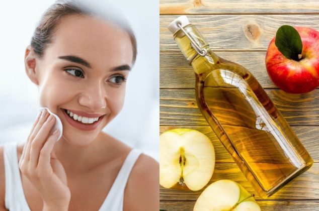 Cómo usar el vinagre de manzana para eliminar manchas de la piel