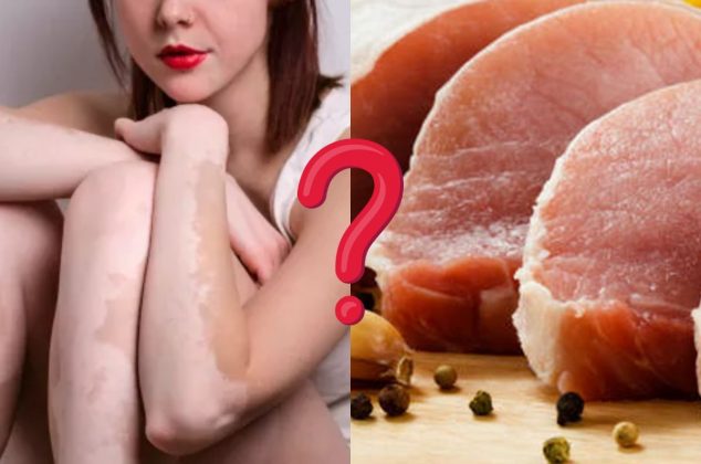 ¿Realmente la carne de puerco puede causar vitiligo? Aquí la respuesta