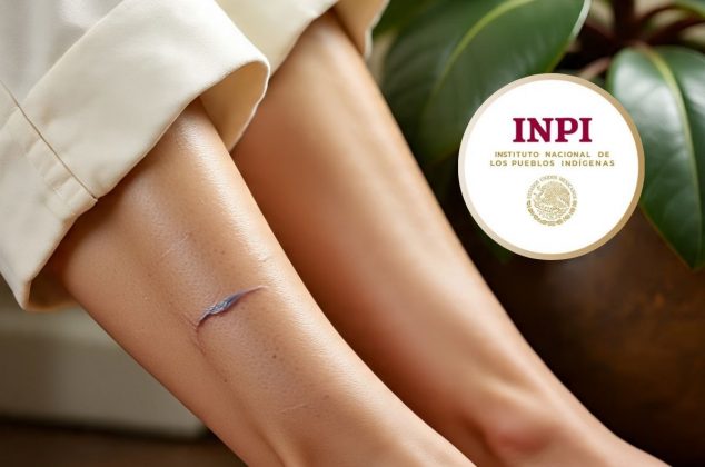 La planta medicinal que actúa sobre las varices desde la primera aplicación, según expertos del INPI