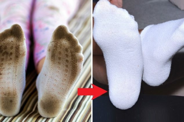 Aprende el mejor truco para blanquear calcetines sucios y manchados