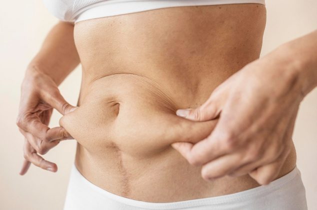 Reduce la barriga caída con estos consejos simples y efectivos
