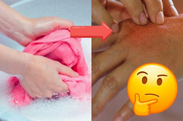 Este error común al lavar la ropa causa irritación en la piel y así es como puedes evitarlo