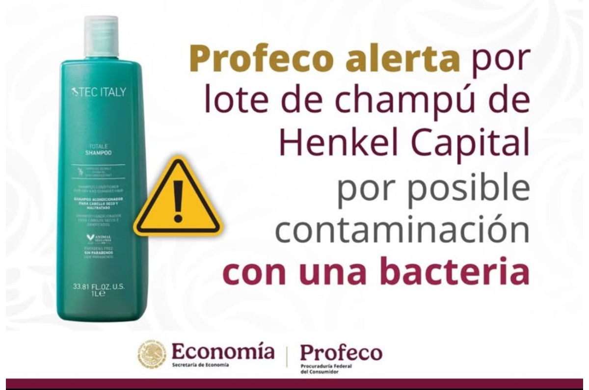 Profeco lanza advertencia por shampoo totale